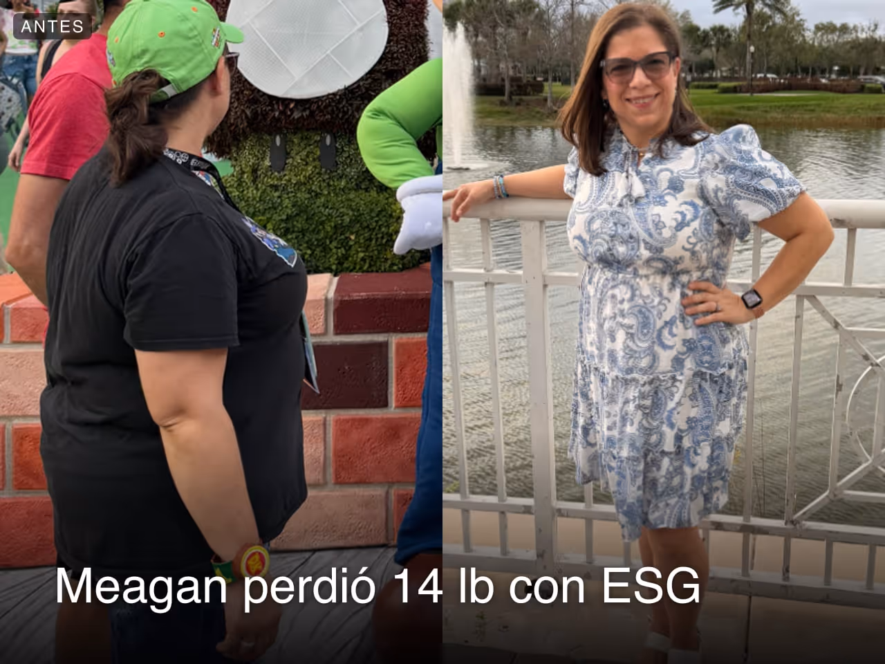 Imagen de antes y después de Meagan, quien perdió 14 libras en 6 meses con ESG