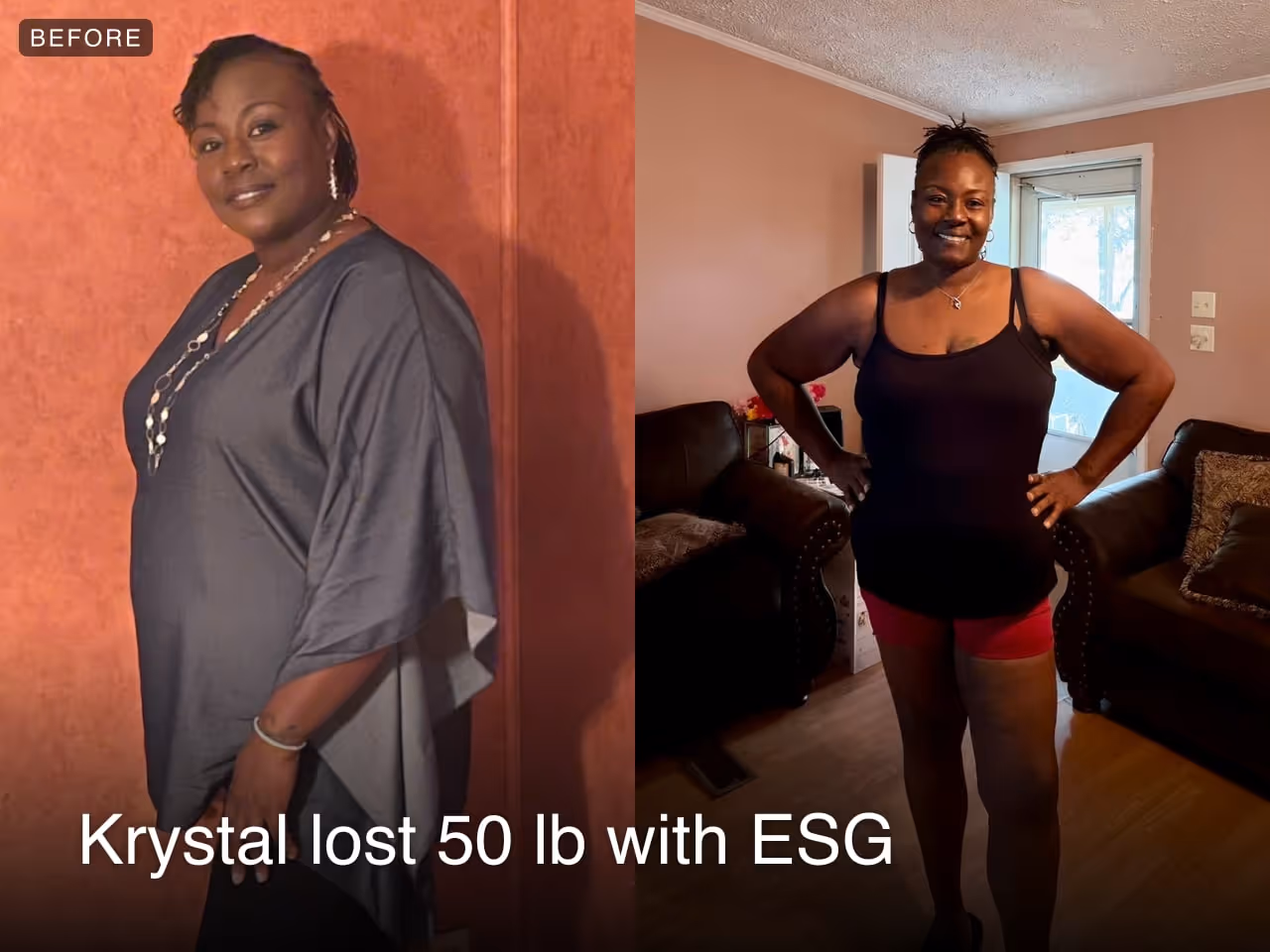 Before and after image of Krystal who lost 50 lbs in 6 months with ESG