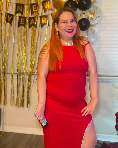 Isola after a gastric balloon