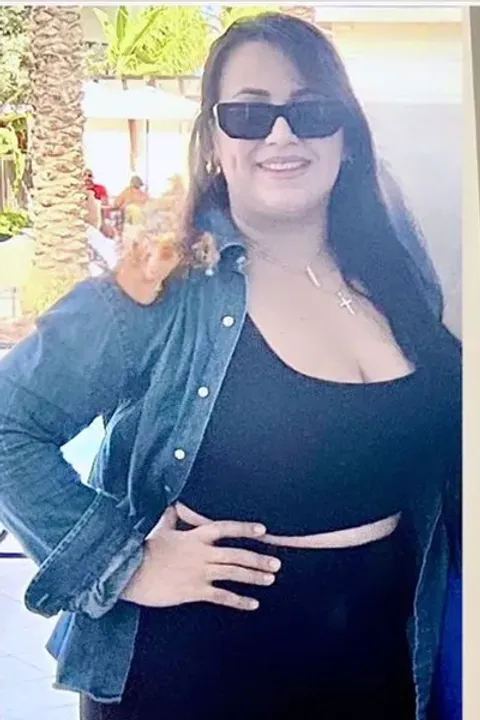 Anais antes de un balón gástrico