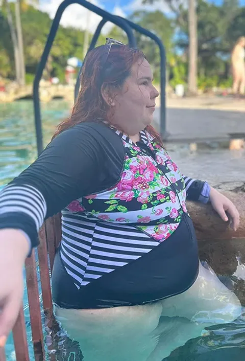 Isola before a gastric balloon
