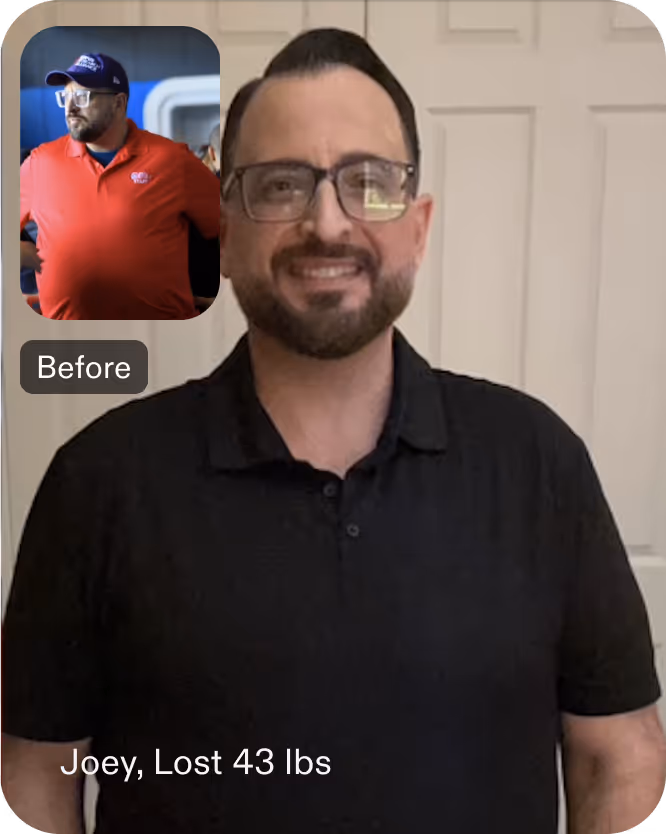 Joey lost 43 lbs with an ESG with Everself