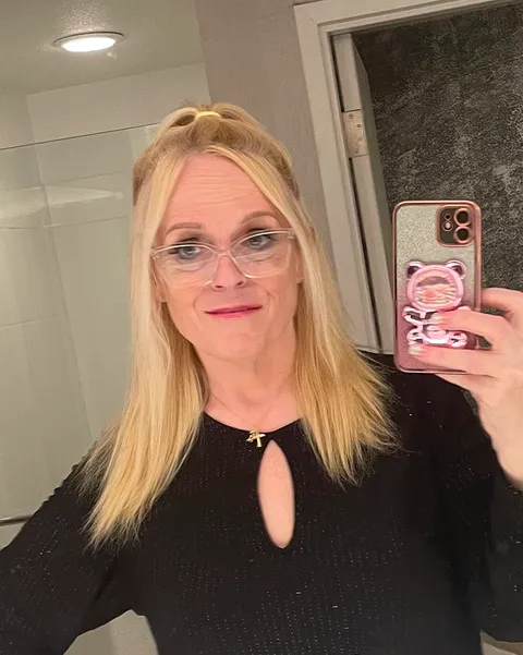 Jackie after TORe gastric bypass revision