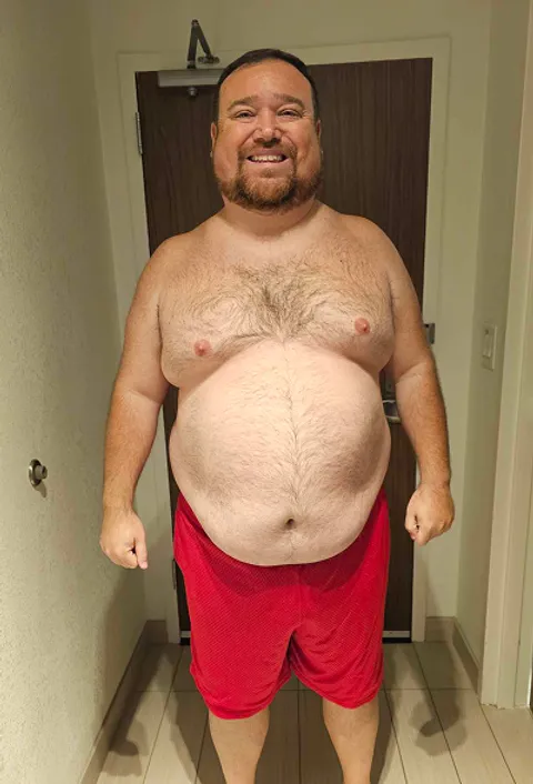 Clint before a gastric sleeve revision