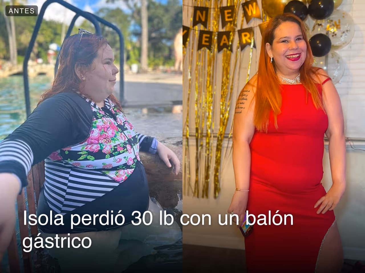 Imágenes de antes y después de Isola, quien perdió 30 libras en 8 meses tras un procedimiento de Balón Gástrico con Everself