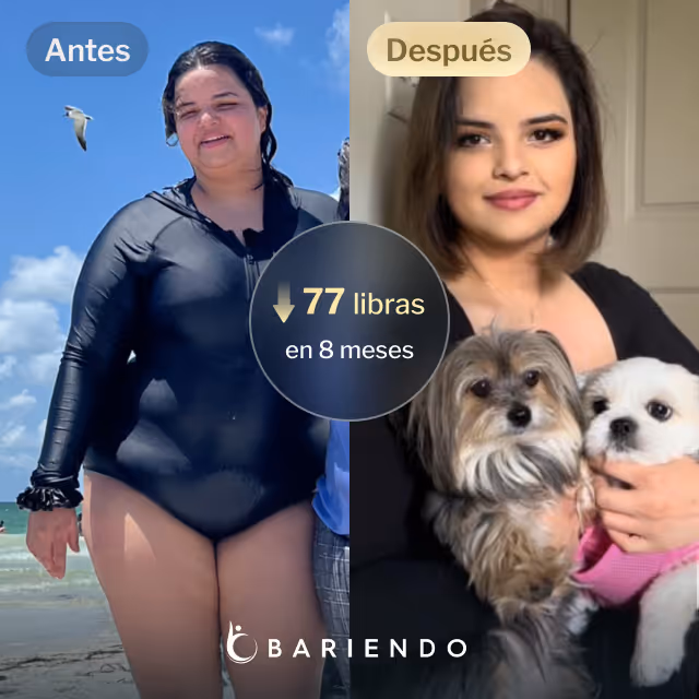 Imágenes de antes y después de Nicole, una paciente de Everself ESG que se endurece el estómago y que pierde 77 libras en 7 meses