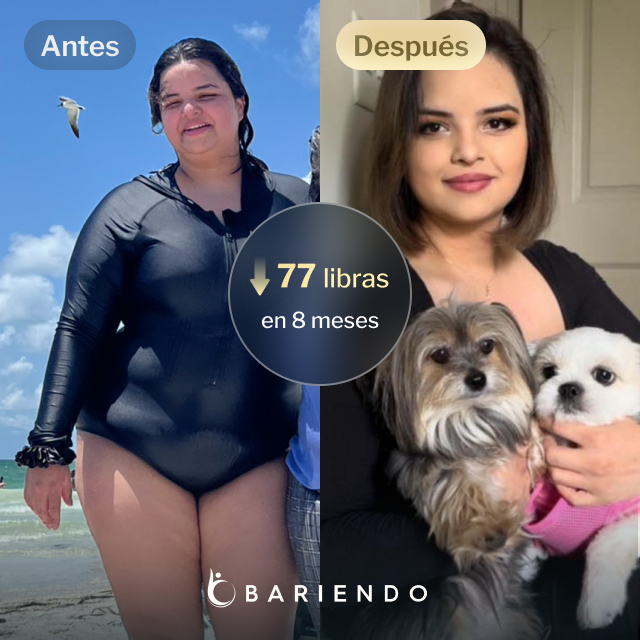 Imágenes de antes y después de Nicole, una paciente de Everself ESG que se endurece el estómago y que pierde 77 libras en 7 meses