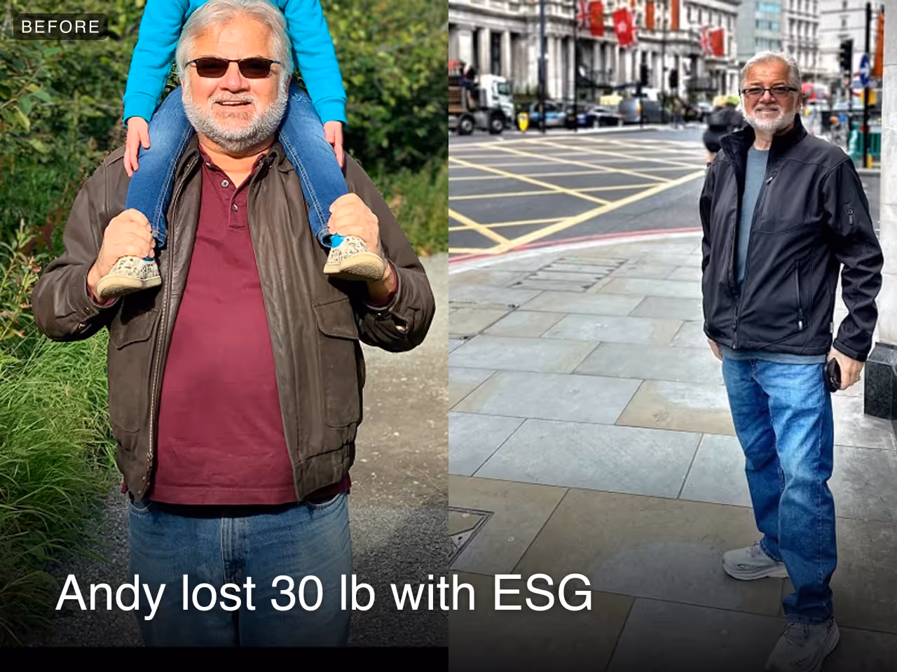 Quote from Andy, a Everself ESG patient
