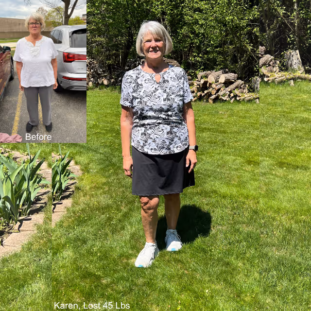 Before and after image of Karen who lost 45 lbs in 1 year with ESG