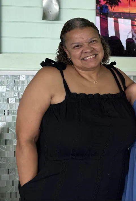 Barbara before ESG Stomach Tightening