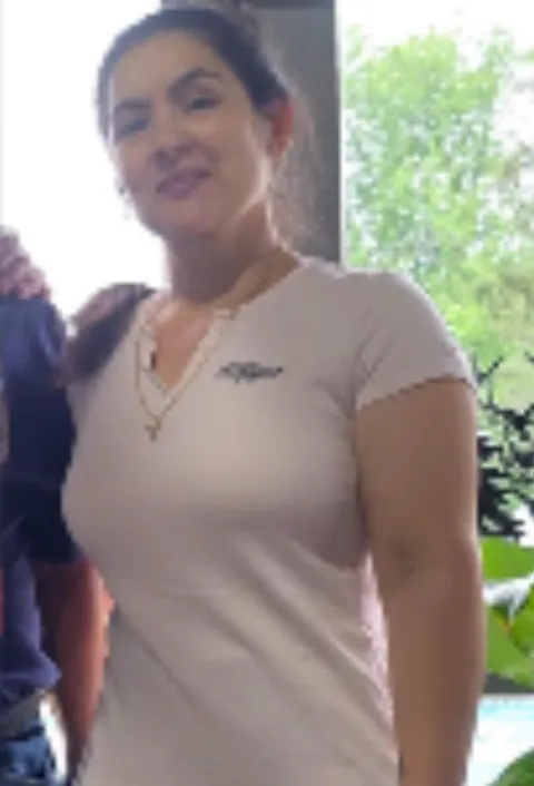 Maria after ESG Stomach Tightening