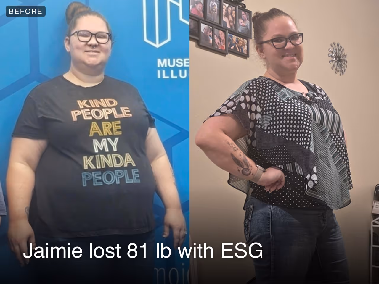 Before and after image of Jaimie who lost 81 lbs in 5 months with ESG