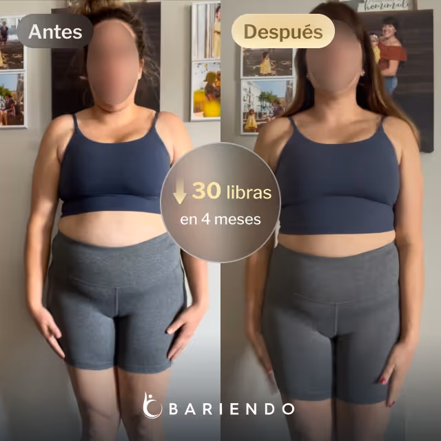 Imágenes de antes y después de Iris, quien perdió 30 libras en 4 meses después de un procedimiento de Balón Gástrico con Everself