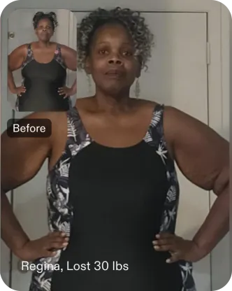 Regina lost 30 pounds with consistent support after her TORe procedure