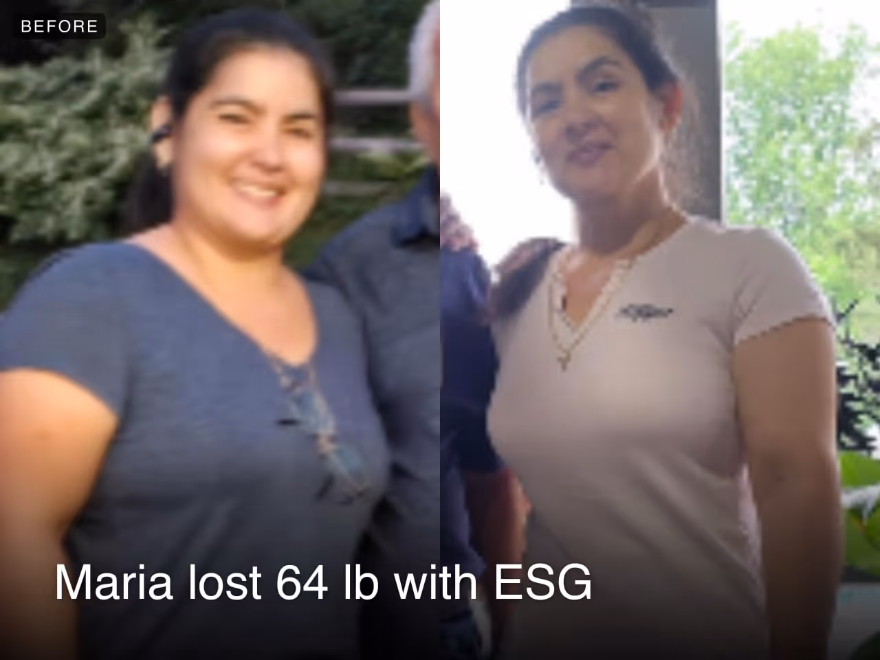 Before and after image of Maria who lost 64 lbs in 12 months with ESG