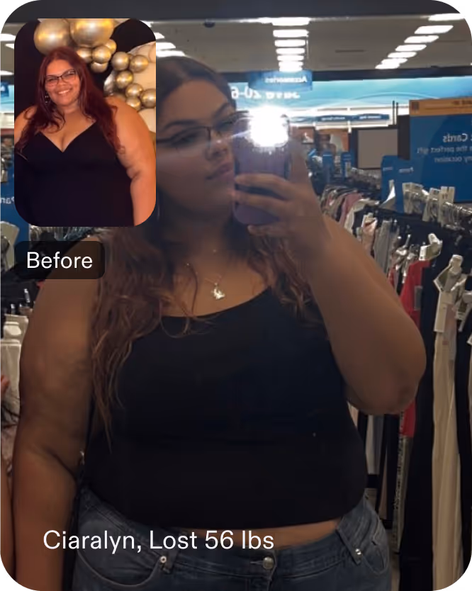 Ciaralyn lost 56 pounds in 3 months with an ESG from Everself
