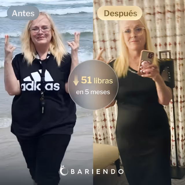 Imágenes de antes y después de Jackie, quien perdió 51 libras en 5 meses después de un procedimiento TORe con Everself