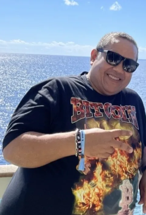 Eduardo before ESG Stomach Tightening