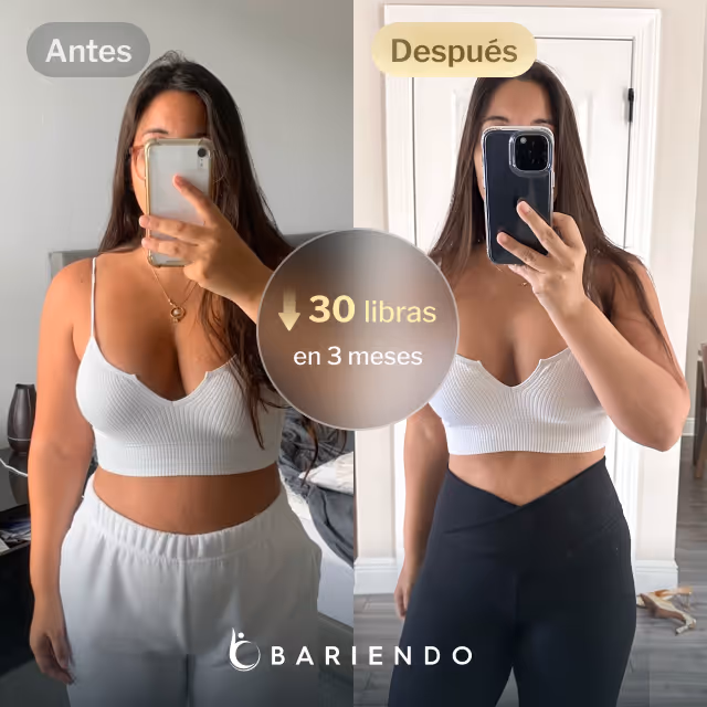 Imágenes de antes y después de Patricia, una paciente de Reducción de Estómago ESG de Everself que perdió 30 libras en 3 meses