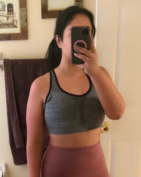 Glorimar after a gastric balloon