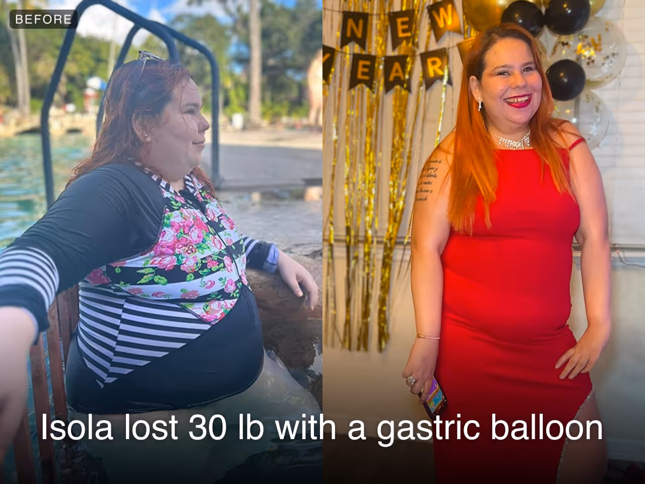 Before and after images of Isola who lost 30 pounds in 8 months after a Gastric Balloon procedure with Everself