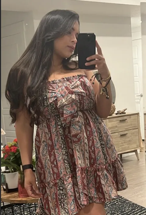 Daniela before a gastric balloon