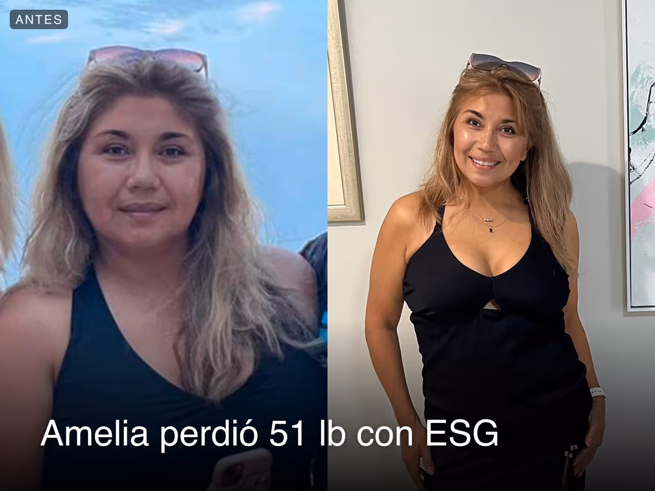 Before and after image of Amelia who lost 51 lbs with ESG
