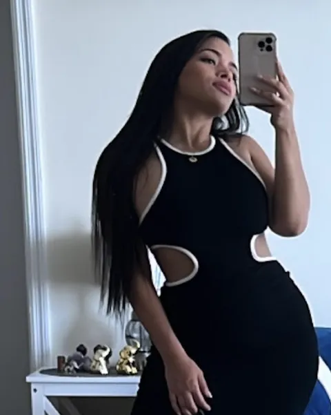 Daniela after a gastric balloon