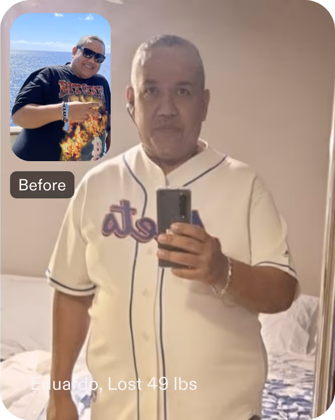 Before and after images of Cesar who lost 49 pounds in 5 months through Everself's ESG Stomach Tightening® procedure
