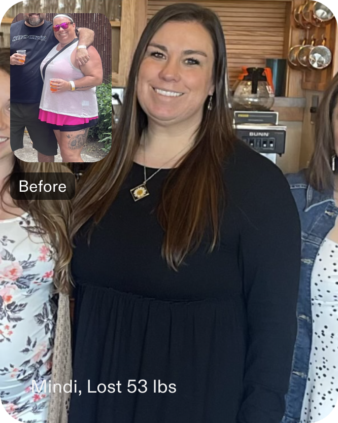 Before and after images of Mindi who lost 43 pounds in 4 months through Everself's non-surgical revision procedure