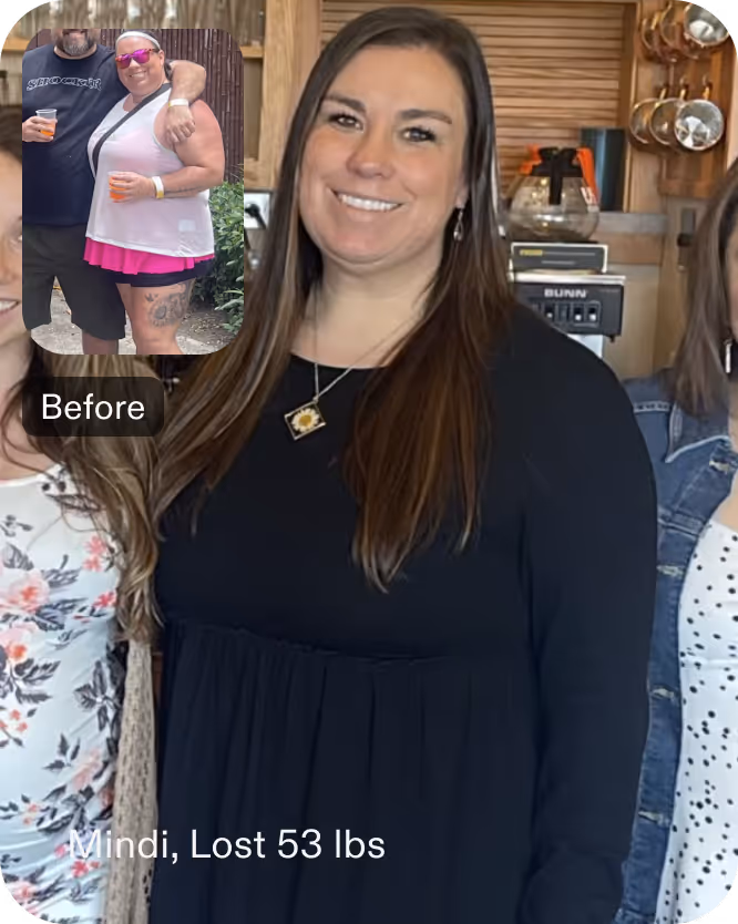 Before and after images of Mindi who lost 43 pounds in 4 months through Everself's non-surgical revision procedure