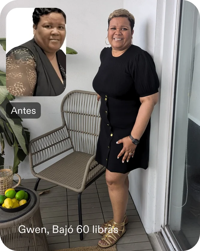 Imágenes de antes y después de Gwendolyn que perdió 30 libras en 5 semanas después de un procedimiento ESG
