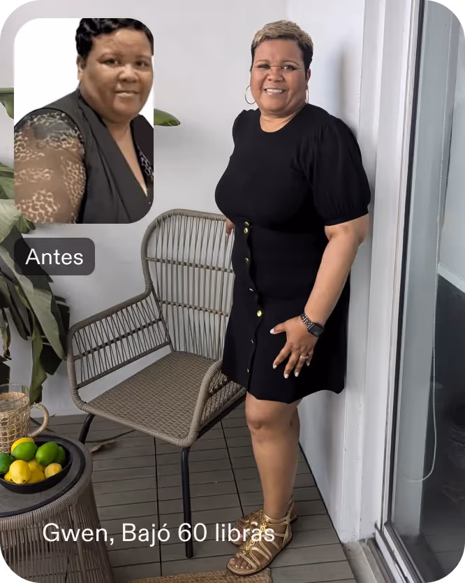 Imágenes de antes y después de Gwendolyn que perdió 30 libras en 5 semanas después de un procedimiento ESG