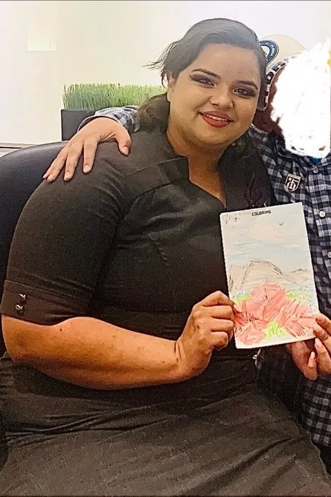Nicole before ESG Stomach Tightening
