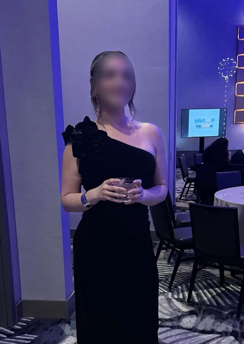 Natalie after ESG Stomach Tightening