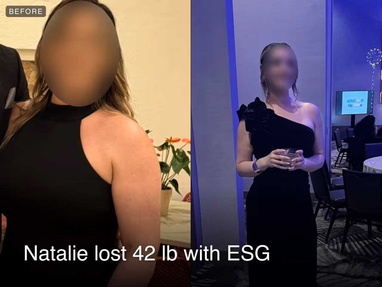 Before and after images of Natalie who lost 42 pounds in 7 months after a ESG procedure with Everself