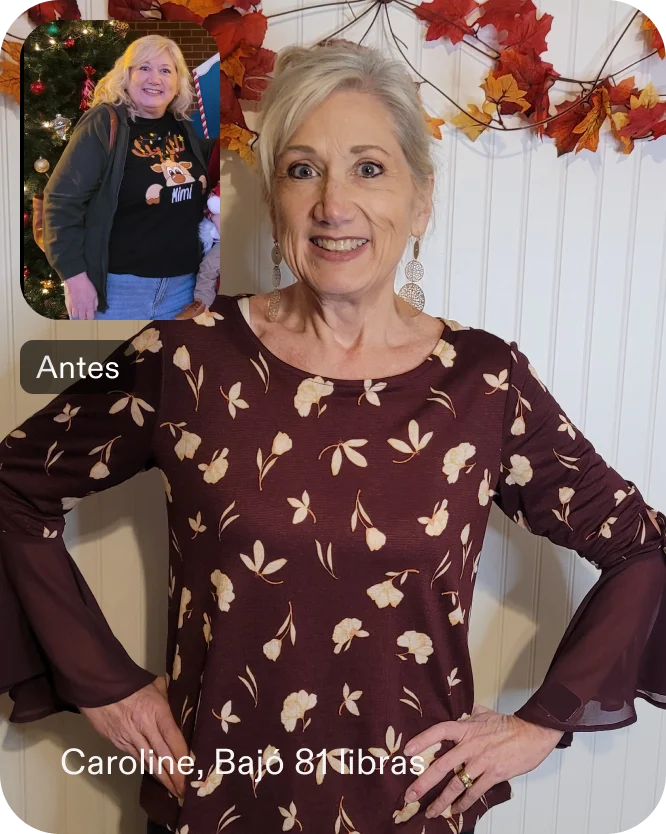 Caroline perdió 23 kilos con una ESG de Everself