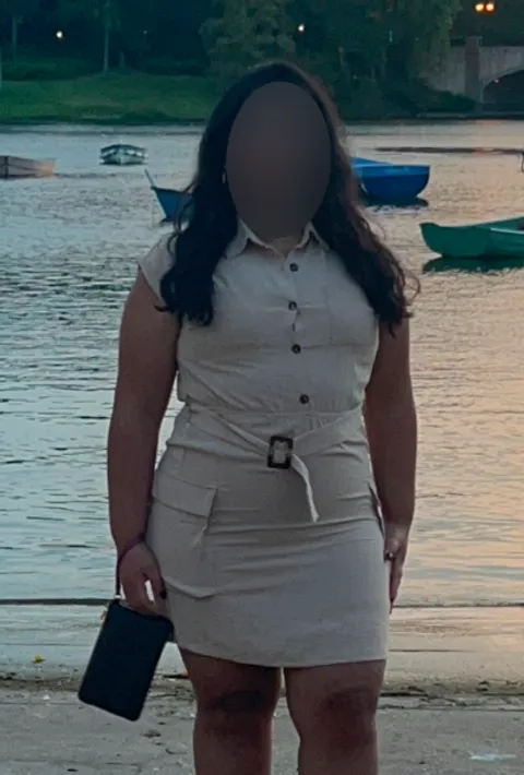 Glorimar before a gastric balloon