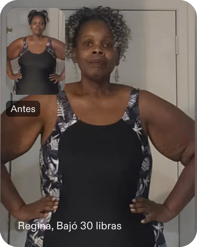 Imágenes de antes y después de Regina que perdió 14 kilos con un procedimiento TORe
