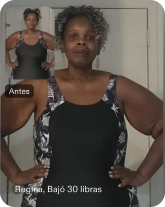 Regina perdió 14 kilos con apoyo constante después de su procedimiento TORe