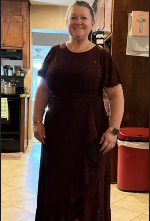 Danna after ESG Stomach Tightening