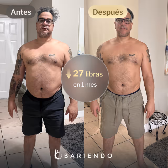 Imágenes de antes y después de César, quien perdió 49 libras en 5 meses gracias al procedimiento de Reducción de Estómago ESG de Everself