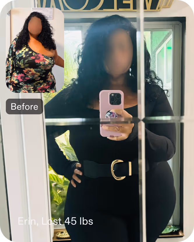 Before and after images of Erin who lost 45 pounds in 3 months after a Revision of Sleeve Gastrectomy Procedure - SIS with Everself