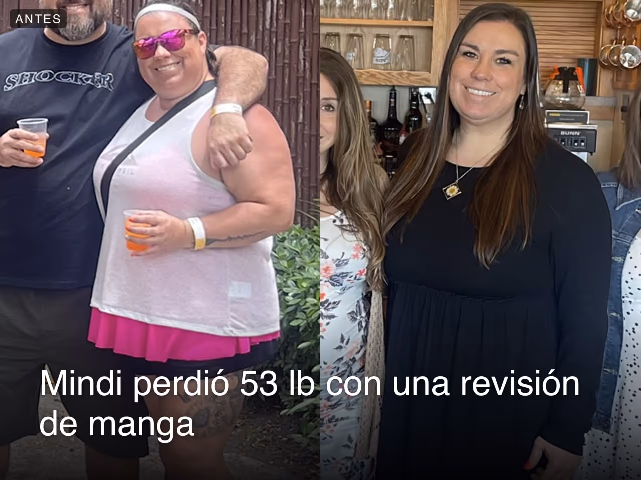 Imágenes de antes y después de Mindi, la paciente ESG de Everself que perdió 43 libras en 4 meses