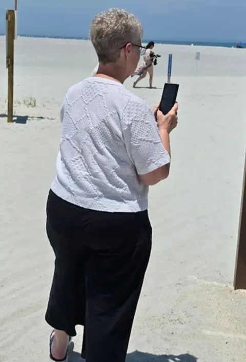 Diane before TORe gastric bypass revision