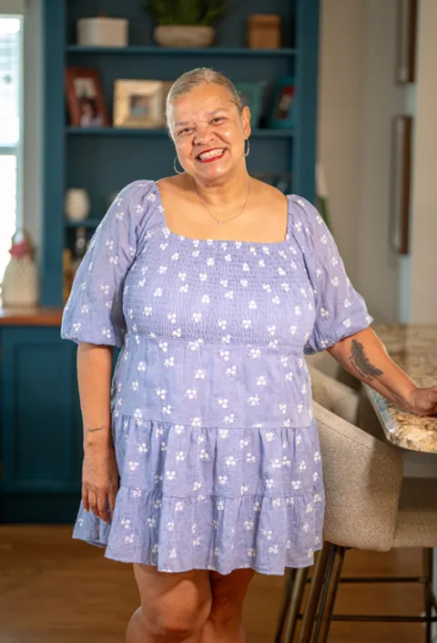Barbara after ESG Stomach Tightening