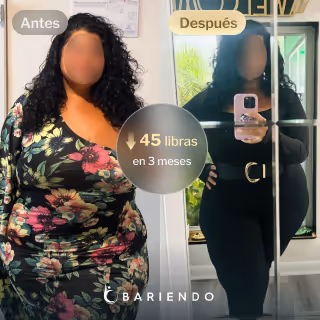 Imágenes de antes y después de Erin, quien perdió 45 libras en 3 meses después de una revisión de gastrectomía en manga - SIS con Everself
