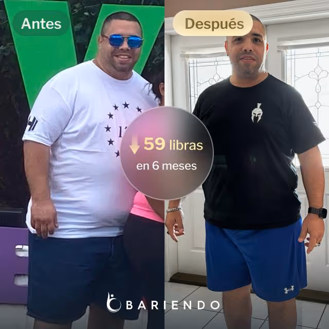 Imágenes de antes y después de Oscar, quien perdió 59 libras en 6 meses a través del procedimiento de Reducción de Estómago ESG de Everself.