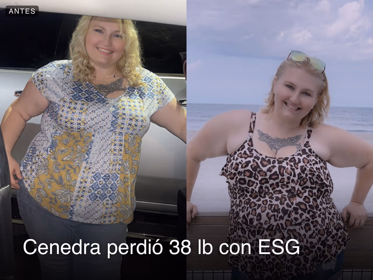 Cenedra perdió 38 libras con un ESG con Everself