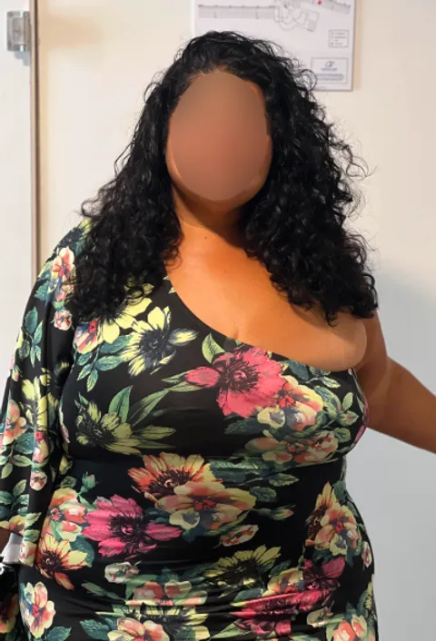 Erin before a gastric sleeve revision